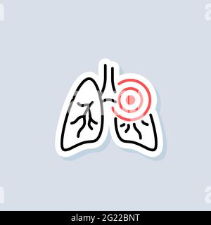 Lungs sticker. Pneumonia icon. Inflammatory in lungs. Asthma or tuberculosis. Vector on isolated background. EPS 10. Stock Vector