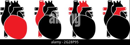 Human heart with red selected parts. Anatomically correct organ illustration. Stock Vector