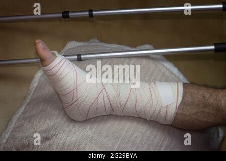horizontal shot of an adult male with his leg in a cast and bandaged up on a foot stool with crutches lying beside him. Concept of rehabilitation of p Stock Photo