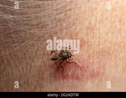 Deer fly, Lipoptena cervi biting on human neck, this insect is active during autumn and may bite human in rare occasions Stock Photo
