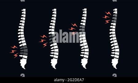 Back pain vector icon illustration isolated on black. Backache spines set. Damaged Disks Stock Vector
