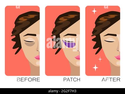Woman cartoon face with skin problems before after self or cosmetology care. Bruises under the eyes. Cosmetic effect of cream, mask, patches. Young gi Stock Vector
