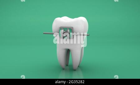 Teeth braces metal. Green background. 3d render. Stock Photo