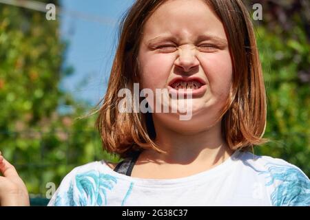 A young girl makes a funny face. Her eyes are closed and her mouth wide open, showing the retainer on teeth Stock Photo