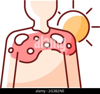 Peeling skin RGB color icon Stock Vector