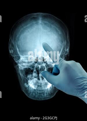 Human skull X-ray image view image hand in glove isolated on black Stock Photo