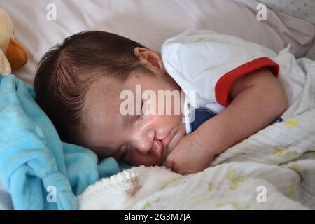 Baby with Cleft lip and cleft palate. Stock Photo