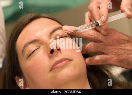 Healthcare concept - Anesthesia - Chalazion during eye examination and operation Stock Photo