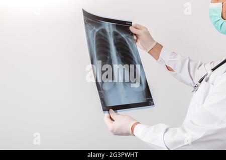 Doctor looking at chest x-ray Stock Photo