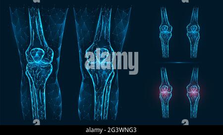Abstract polygonal illustration of human knee anatomy. Disease, pain and inflammation of the knee joints isolated on blue backgr Stock Photo