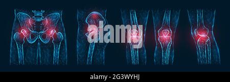 Polygonal vector illustration of pain or inflammation of the bones in the pelvis, hip joint, and knee joints isolated on a dark Stock Photo