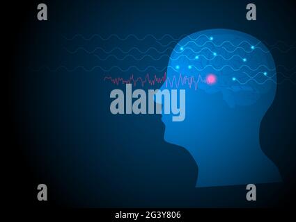 Focal seizure. Vector illustration of human brain and electroencephalograhy or EEG originating from temporal lobe.
