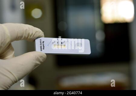 A medical personnel shows a positive result of SARS-COV-2 Rapid Ag test, positive Covid-19 corona virus test on a blurred background, novel pandemic c Stock Photo