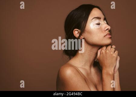 Portrait of woman with vitiligo seems down due to her skin problem. Side view of young woman in praying pose against brown background. Stock Photo