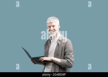 Modern technologies. Happy albino guy using laptop computer over turquoise background, enjoying remote job offers Stock Photo