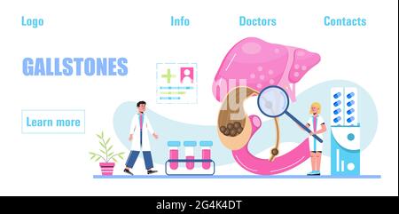 Gallbladder concept vector. Doctors treat gallstones. Biliary dyskinesia ptoblems. Healthcare, medical template for medical website, banner. Stock Vector