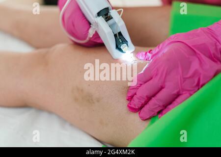 Expertise giving carboxytherapy treatment to mature woman Stock Photo