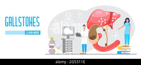 Gallbladder concept vector. Doctors treat gallstones. Biliary dyskinesia ptoblems. Web, landing page template for medical website, banner. Medical sup Stock Vector