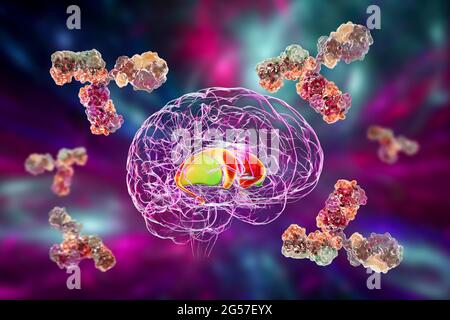 Anti-basal ganglia antibodies, illustration Stock Photo