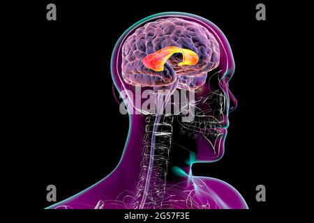 Human brain with highlighted corpus callosum, illustration Stock Photo