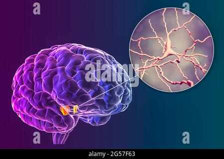 Substantia nigra and dopaminergic neurons, illustration Stock Photo