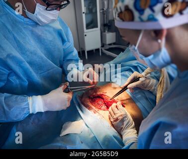 Medical workers in sterile gloves performing plastical surgical operation. Doctors wearing surgical uniforms while removing excess fat from patient abdomen in hospital. Concept of abdominoplasty. Stock Photo