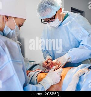 Medical workers performing plastical surgical operation in operating room. Plastic surgeon and assistant removing excess fat from patient abdomen. Concept of abdominoplasty and cosmetic surgery. Stock Photo