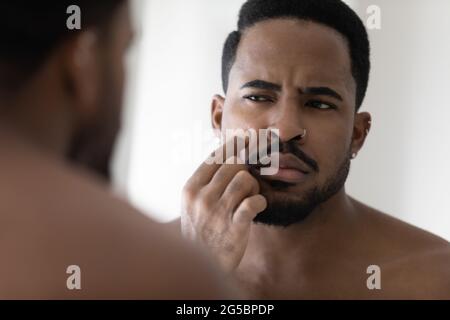 Concerned metrosexual young Black guy with stylish beard Stock Photo
