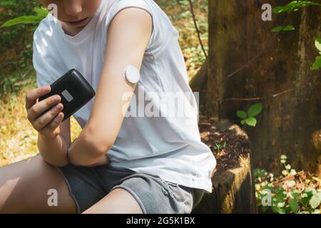 Concept of life of a child with diabetes and glycemic control. Summer vacation, a walk in the forest: a diabetic boy doing sports in the open air Stock Photo