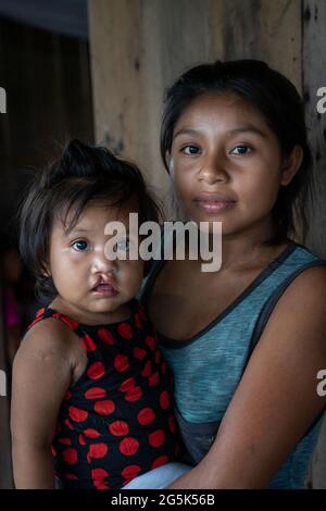 Young Riberenos mother with her baby with a cleft lip in the Peruvian Amazon Stock Photo
