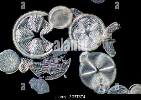 diatom (Diatomeae), diatoms from Patuxent River, dark field microscopic image, USA, Maryland Stock Photo