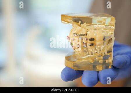 Dental specialist showing a set of braces on teeth set Stock Photo - Alamy