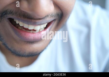 young man open mount checking his teeth  Stock Photo