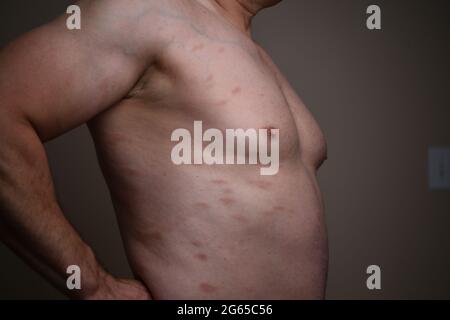 Diagnosis of skin diseases - allergies, psoriasis, eczema, dermatitis. Stock Photo
