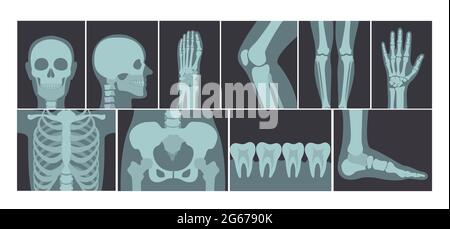 Vector illustration set of many X-rays shots of human body, X-ray pictures of head, hands, legs and other parts of body on white background. Stock Vector