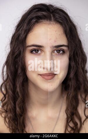 Before and after face skin photo of a young, beautiful brunette girl Stock Photo