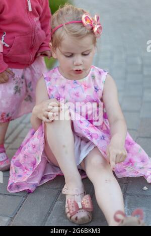 Sore, knee smashed, child complains of pain in knee Stock Photo