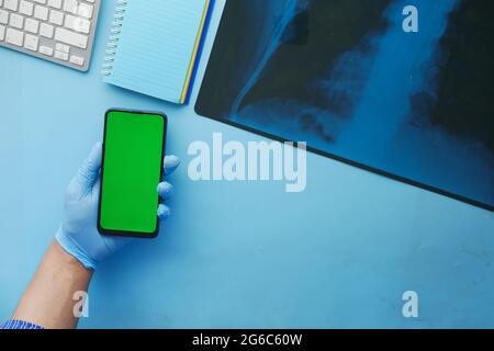 xray photography , smart phone on blue background  Stock Photo