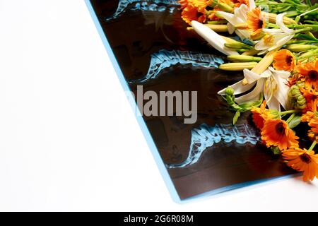 Computed tomography shot of the spine with flowers for congratulations on the day of radiologist, neurologist or traumatologist with place for text Stock Photo