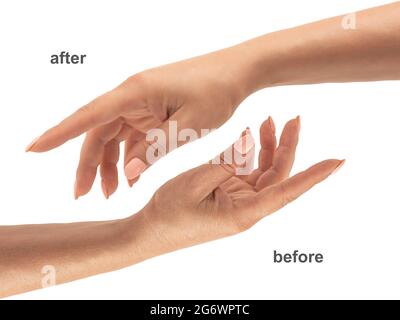 Beautiful Woman Hands. Female Hands before and after Applying Cream, Lotion. Spa and Manicure concept. Female hands with french manicure. Soft skin, s Stock Photo