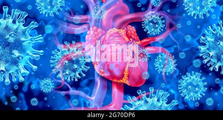 Heart disease, illustration Stock Photo - Alamy