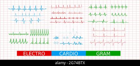 Electrocardiogram heartbeat line, collection of cardiogram line icons. Set of signs for infographic, logo, app development, web design. Stock Vector