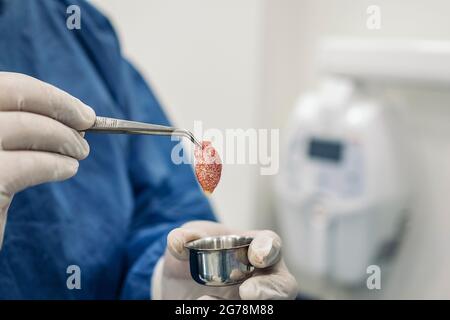Unrecognized dentist wearing protective clothes and latex gloves holding a extraction from a patient. Stock Photo