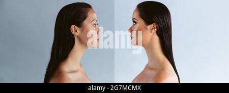 Wide angle shot of woman showing the power of makeup in hiding skin imperfections. Before and after shot of woman suffering from acne problem. Stock Photo