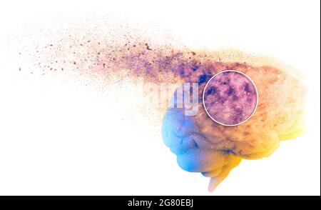 Memory lapses, forgetting things, degenerative disease. Brain problems. Parkinson and alzheimer desease. Mental health. Stroke, synapses and neurnons Stock Photo