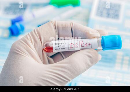 Doctor with a positive blood sample for the new variant detected of the coronavirus strain called covid DELTA. Research of new strains and mutations o Stock Photo