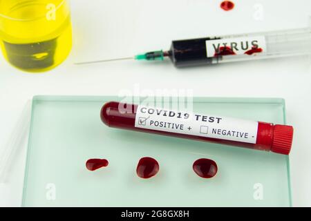 CORONA COVID 19 positive test tube sample blood test drops blood syringe needle Stock Photo