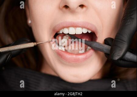 Close-up, cropped snapshot of good looking woman at dentist office during teeth checkup. Dentist examining patient's teeth with mirror and explorer. O Stock Photo