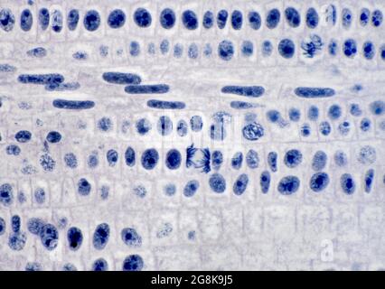 Brightfield photomicrograph, onion root tip, showing cell division ...