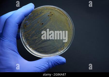 bacterial colonies of Salmonella on selective medium plate on black background Stock Photo